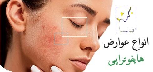 انواع عوارض هایفوتراپی