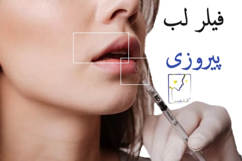 فیلر لب پیروزی
