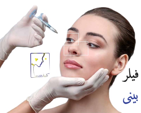 فیلر بینی