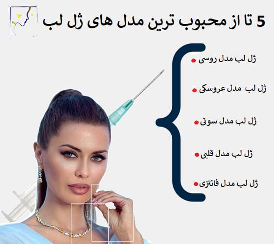 5 تا از محبوب ترین مدل های ژل لب