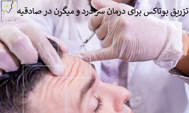 تزریق بوتاکس برای درمان سر درد و میگرن در صادقیه
