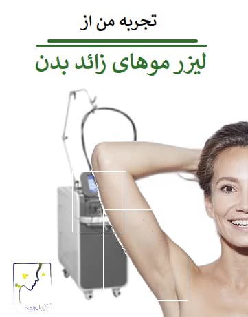تجربه من از لیزر موهای زائد بدن