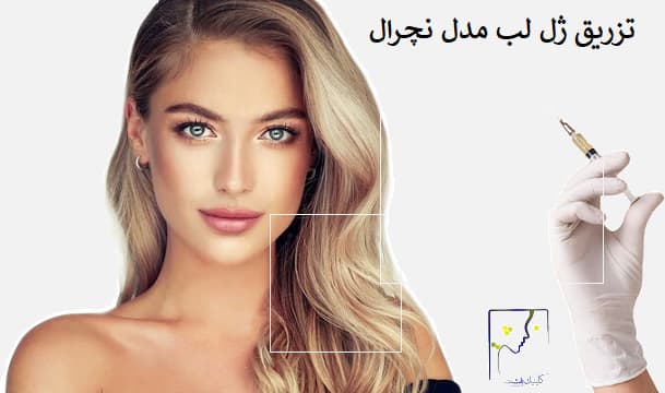 تزریق ژل لب مدل نچرال