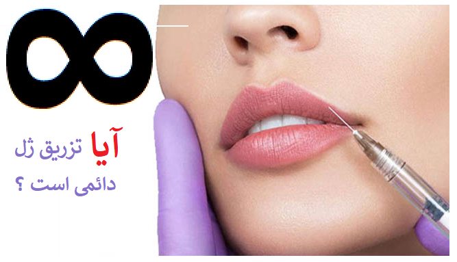 ایا ژل لب دائمی است؟