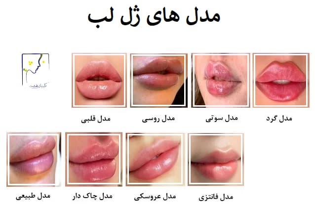 مدل های ژل لب