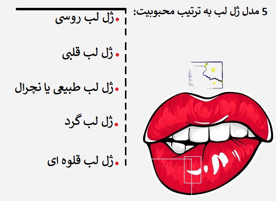 5 مدل ژل لب به ترتیب محبوبیت