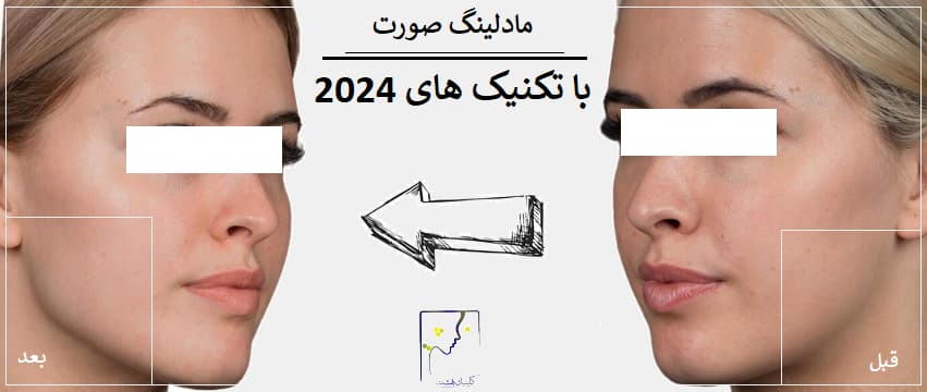 مادلینگ صورت با تکنیک های 2024