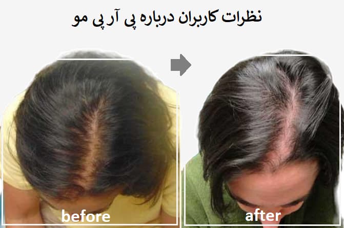 نظرات کاربران درباره پی آر پی مو