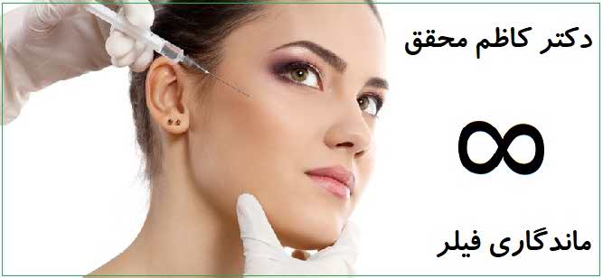 ماندگاری فیلر