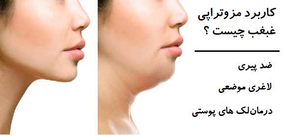 کابرد های مزوتراپی عبعب