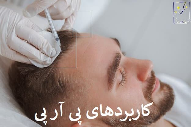 کاربردهای پی آر پی