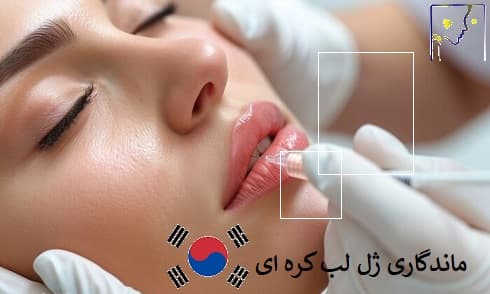 ماندگاری ژل لب کره ای