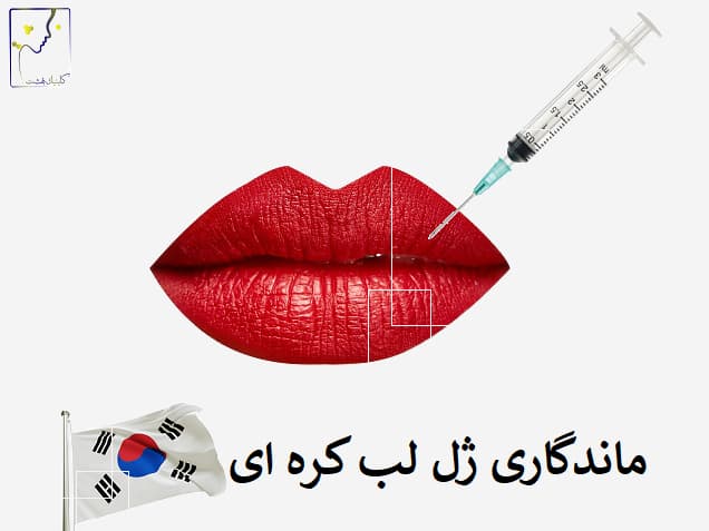 ماندگاری ژل لب کره ای