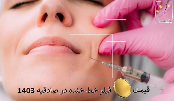 قیمت فیلر خط خنده در صادقیه 1403