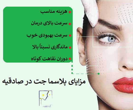 پلاسما جت در صادقیه