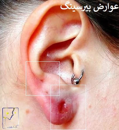 عوارض پیرسینگ