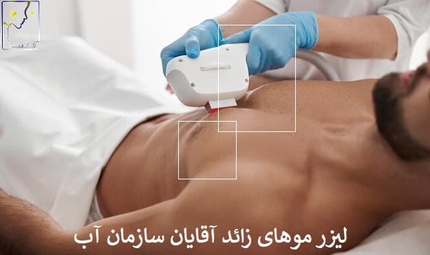 لیزر موهای زائد آقایان سازمان آب