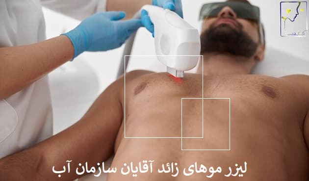 لیزر موهای زائد آقایان سازمان آب